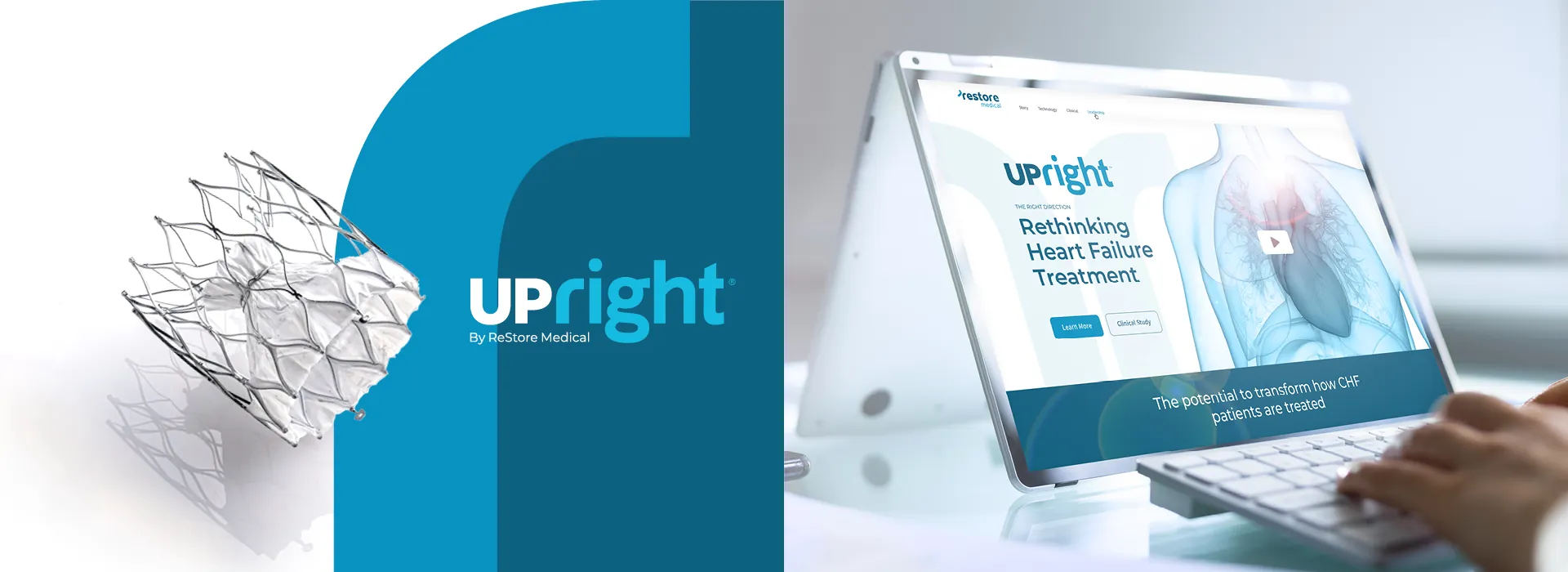 UPRIGHT